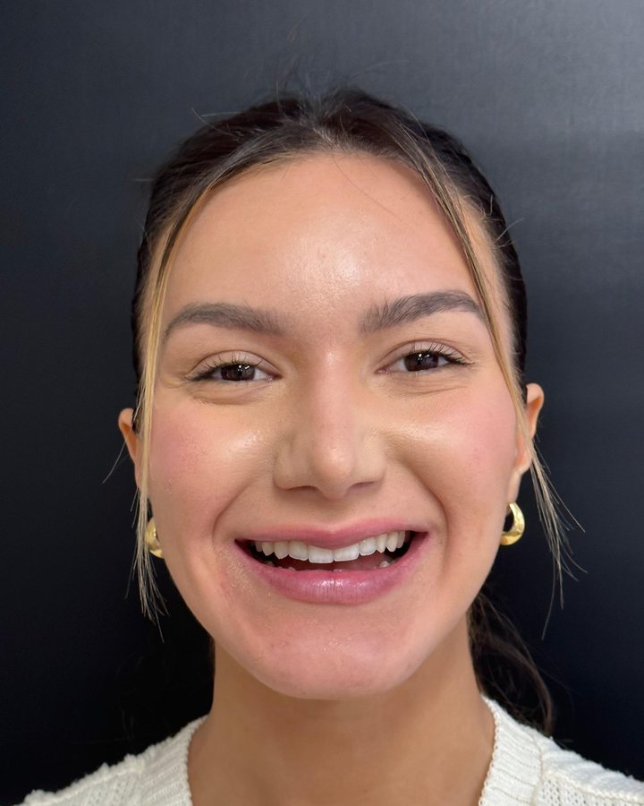 Sorriso antes do tratamento — Caso 1