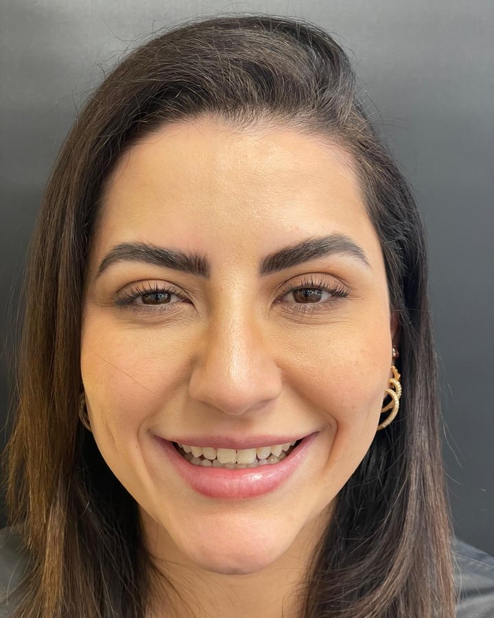 Sorriso antes do tratamento — Caso 2