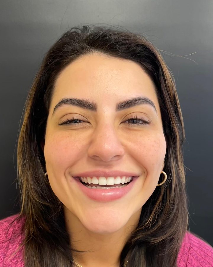 Sorriso depois do tratamento — Caso 2