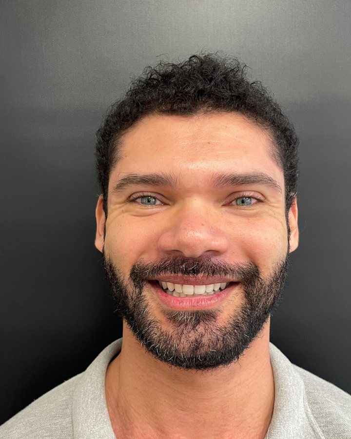 Sorriso antes do tratamento — Caso 3