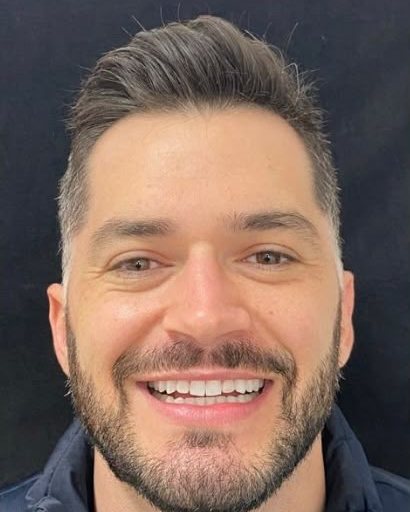Sorriso antes do tratamento — Guilherme