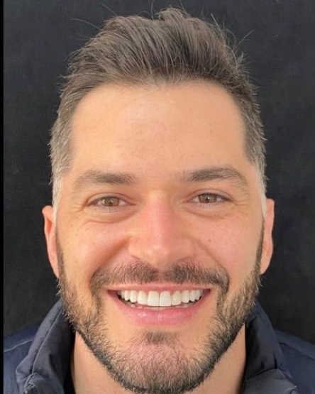 Sorriso depois do tratamento — Guilherme